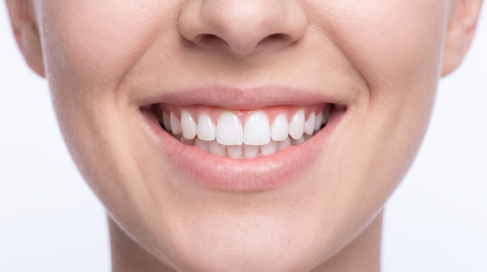 Smile after whitening — conceptual visualisation